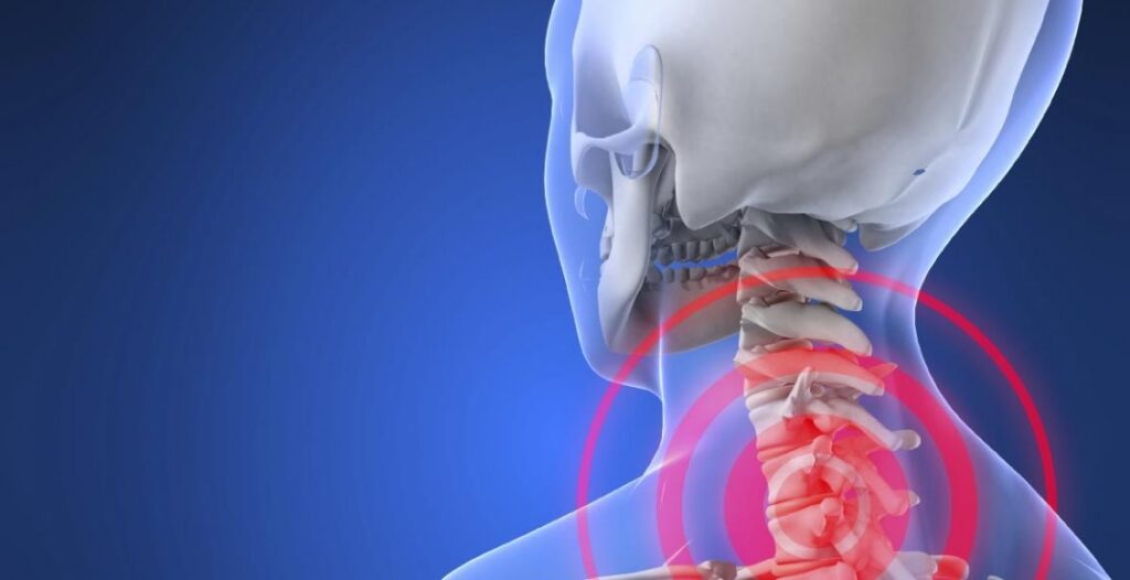 كم تكلفة عملية غضروف الرقبة في مصر؟ وتعرف على أهميتها!