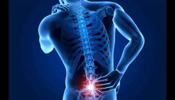 كيفية تشخيص غضروف الظهر