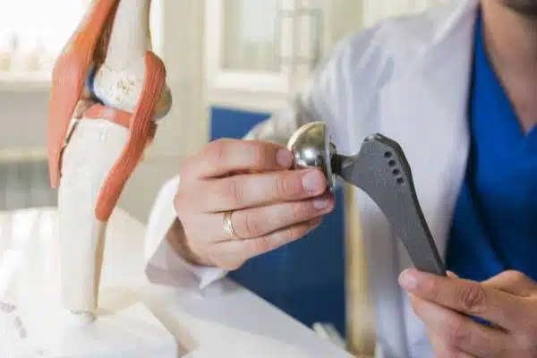 كيفية إجراء عملية تركيب مفصل الحوض؟