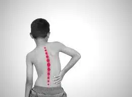 هل يعتبر مرض الجنف اعاقه؟