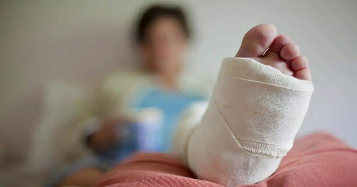 ما هي خطوات العلاج الطبيعي بعد عملية المسمار النخاعي؟