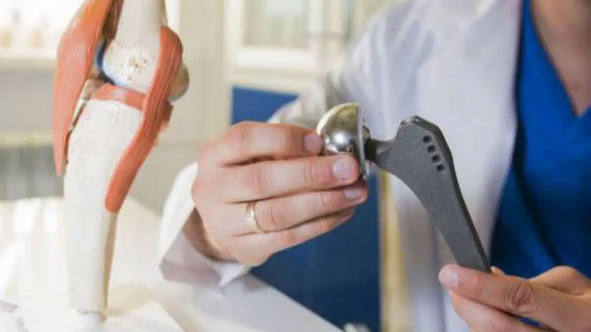 كيف تتم عمليه تغيير المفصل في الفخذ؟