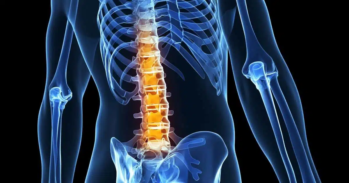 ما هي أسباب الانزلاق الغضروفي وانزلاق الفقرات؟