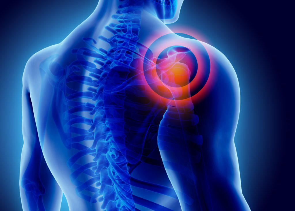 Learn About the Causes of Right Shoulder Tendon Tears and Who Is the Best Doctor to Treat Them?