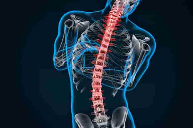 Spinal cord surgery success rate