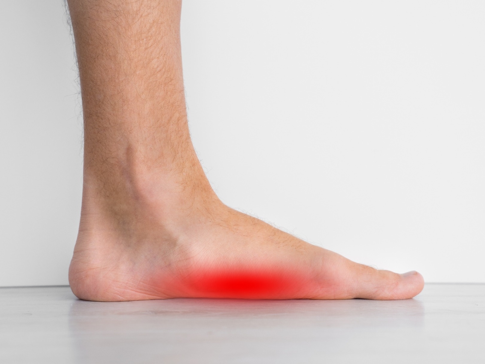 Symptoms of flat feet