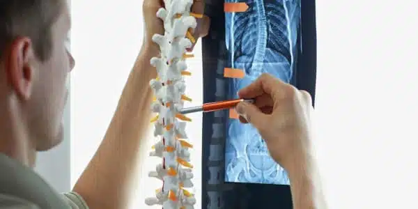 ما هي خطوات إجراء عملية ترقيع العظام؟