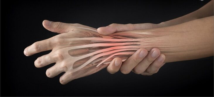 أسباب التهاب الأوتار في اليد والمعصم