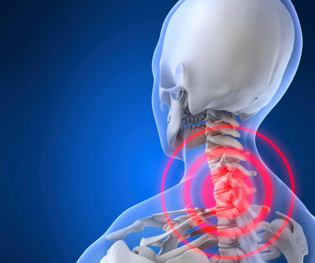 !Explore with us the cost of cervical disc surgery in Egypt and the different treatment methods for this problem