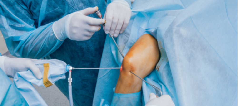 !Knee Arthroscopy Cost in Egypt and Its Main Damages