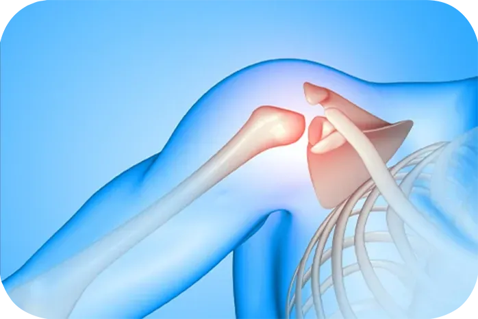 اضرار عملية خلع الكتف