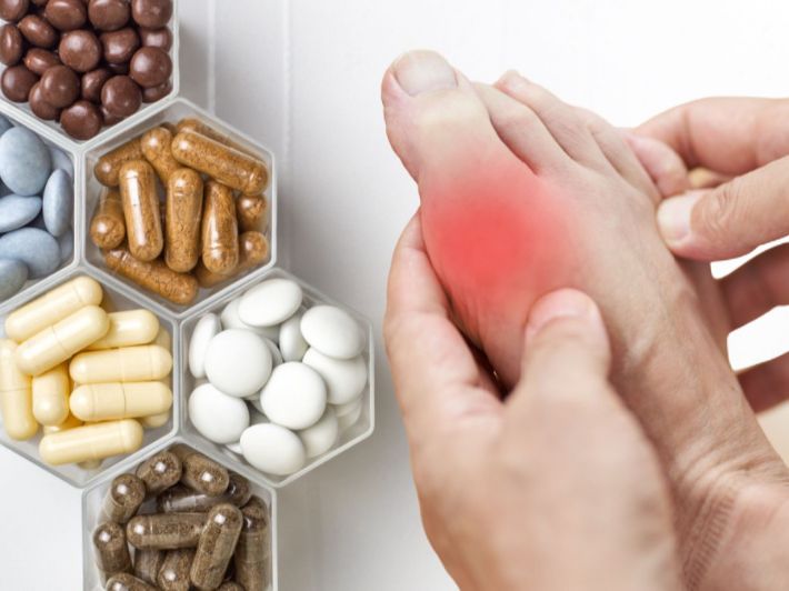 أفضل دواء لعلاج النقرس
