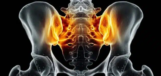 ?What is bone grafting