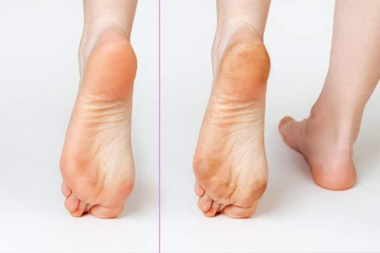 عمليات الفلات فوت