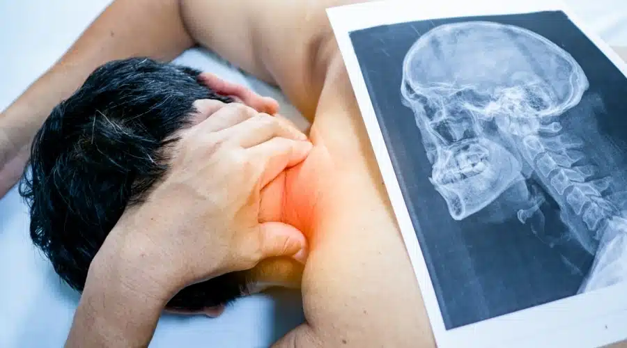 كيف ينام مريض غضروف الرقبة؟