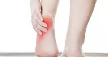 هل النقرس يسبب حرارة القدمين؟