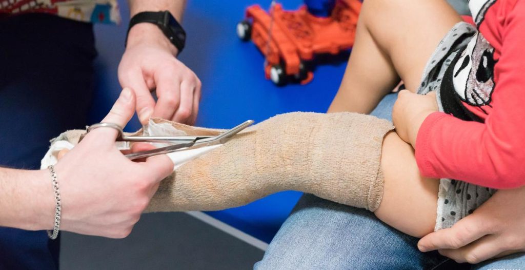 علاج تيبس مفصل الركبة بعد الجبس