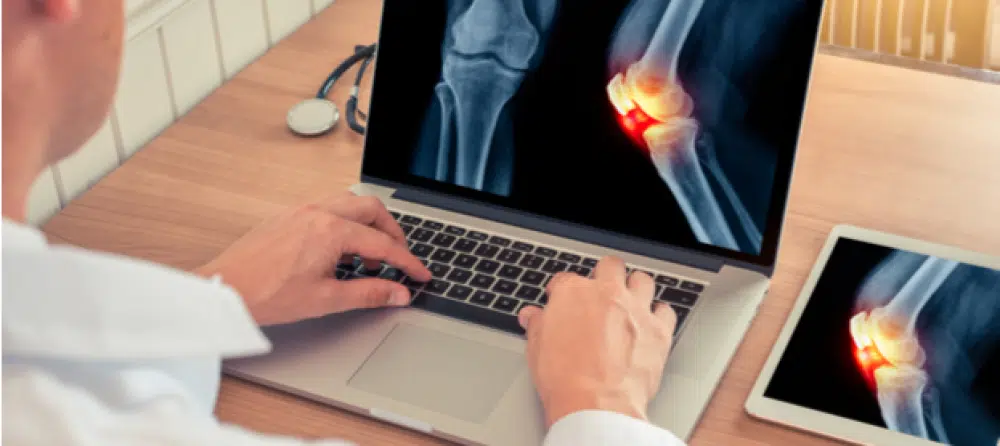 ما هي خطوات إجراء فحص الاشعه الرنين على الركبه؟