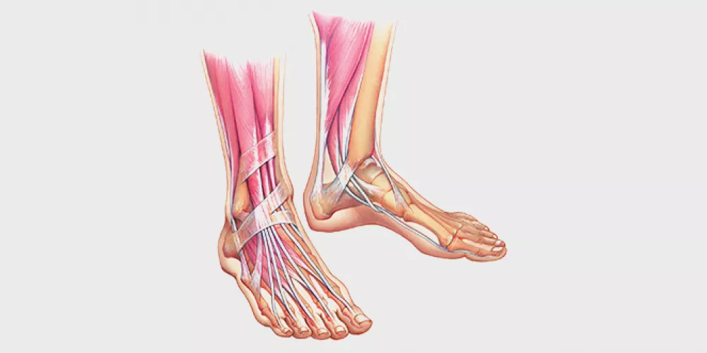 ? Achilles tendon repair surgery and what are the complications of neglecting Achilles tendon stitching