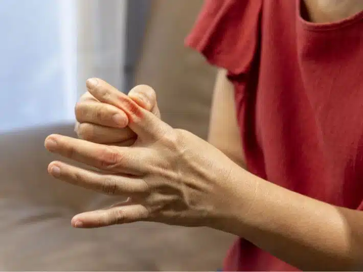 ما هي طرق الوقاية من مرض النقرس؟