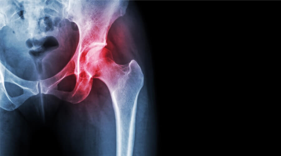 Explore the Most Common Causes of Hip Joint Pain and When It Can Be Serious