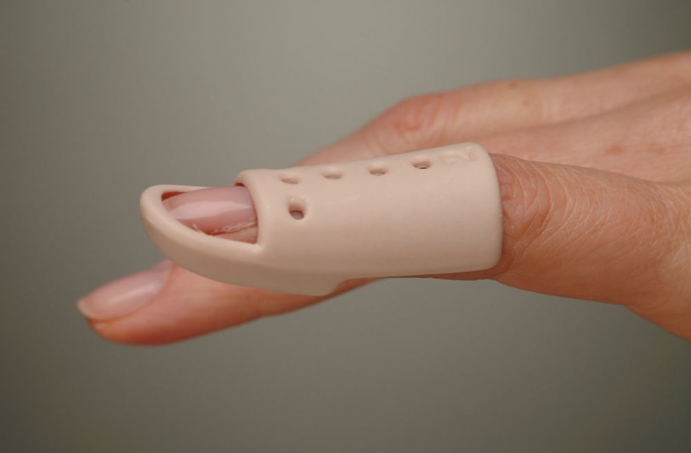 ? Cost of Finger Tendon Cutting Procedure and Can the Cut Heal
