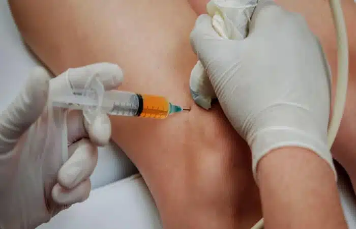 أسعار حقن البلازما للمفاصل