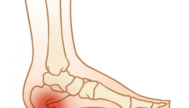 Explore Medication for Treating Bone Spurs and Their Impact on the Back!