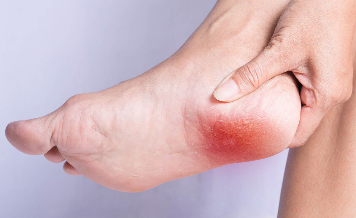 ?Learn about the price of bunion surgery and how you can know if you are suffering from it