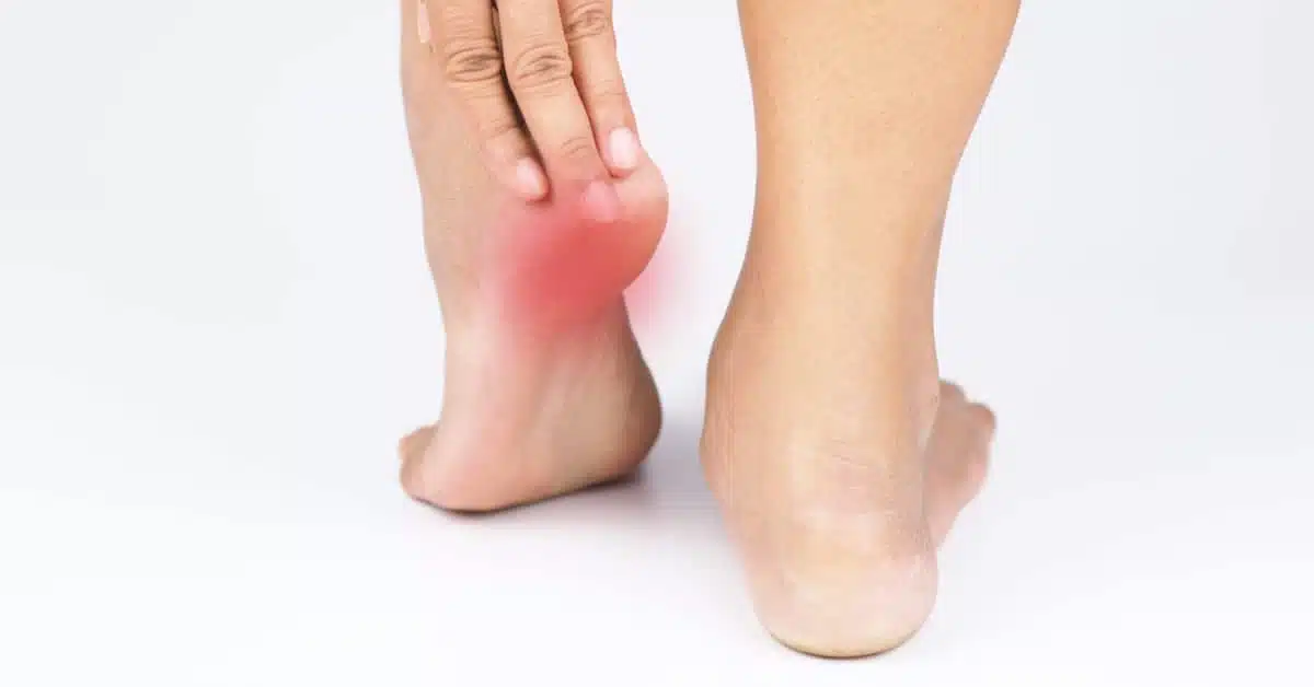 ما أعراض الشوكة العظمية؟