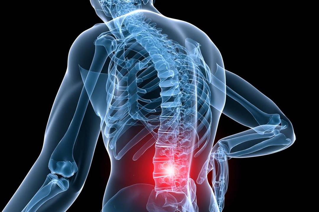 Treatment of Coccyx Inflammation