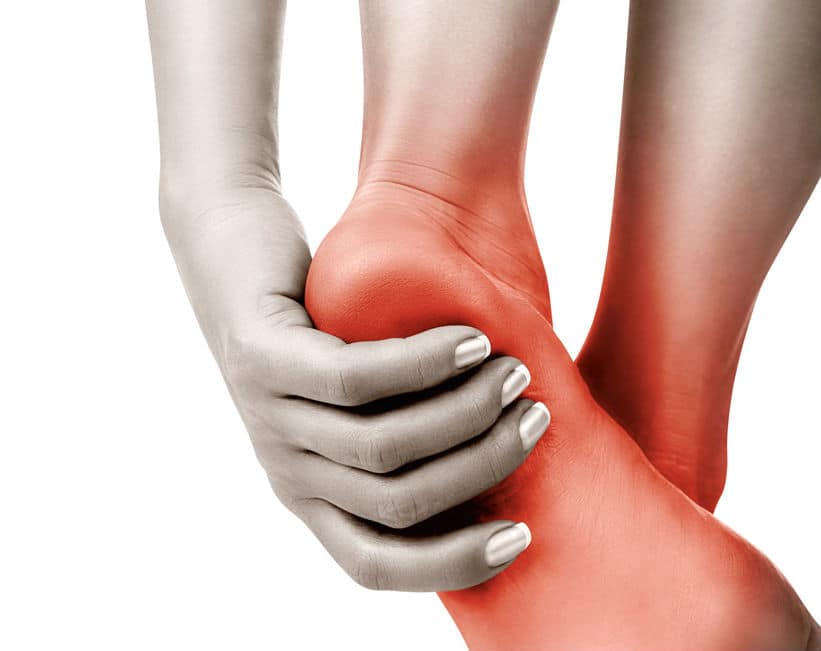!Complete Treatment for Heel Spurs and Key Prevention Methods