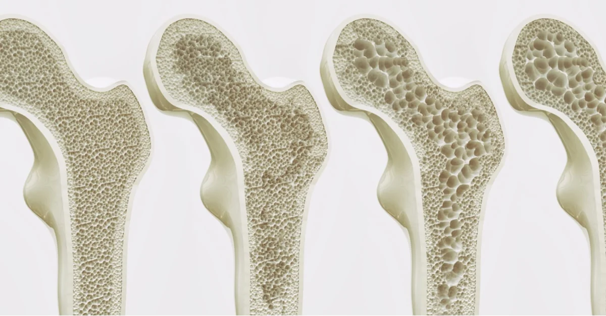 How can you increase bone density?