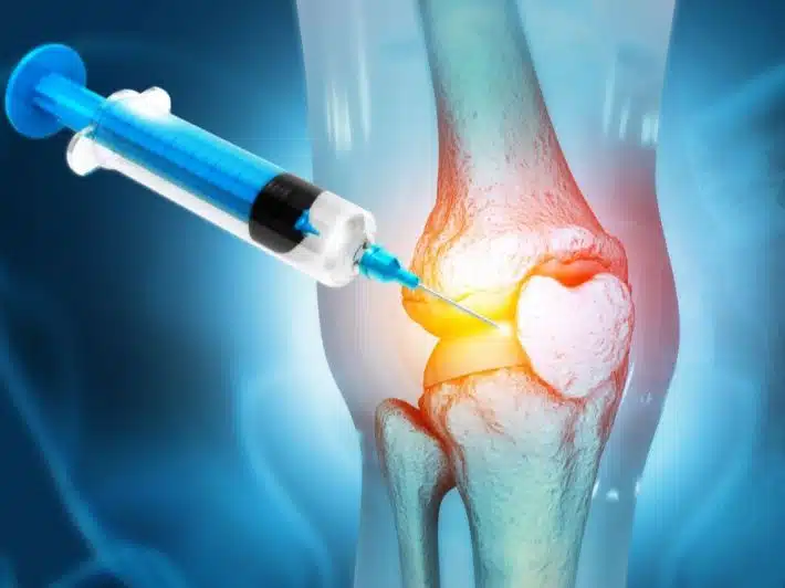 How is hyaluronic acid injected into the knee?