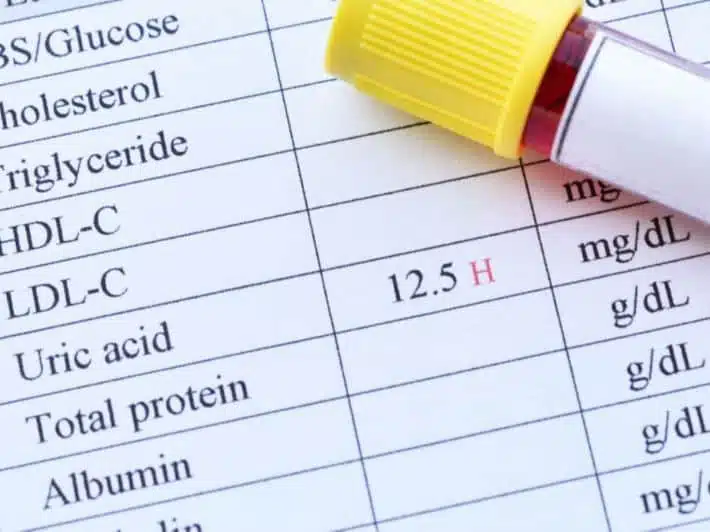 ما هي طرق علاج النقرس بالأدوية؟
