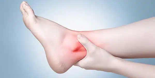 How to diagnose a torn ankle ligament