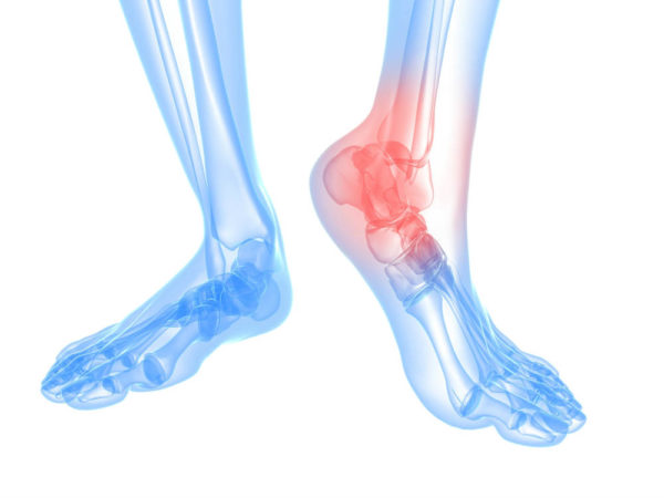 What is the Ankle and Its Most Common Problems?