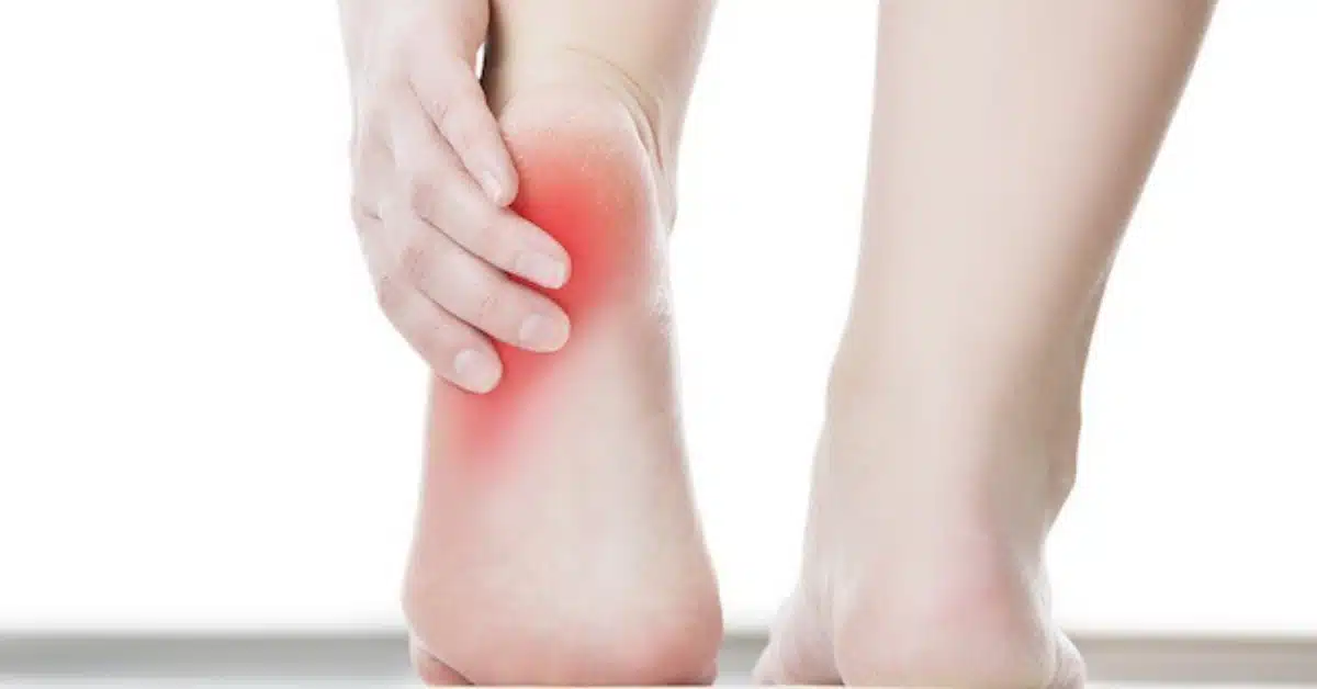 What is the treatment for left heel pain?