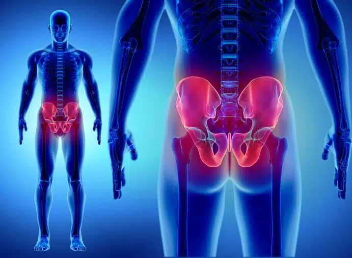 ما هي نسبة نجاح عملية تركيب شريحة ومسامير فى الفخذ؟