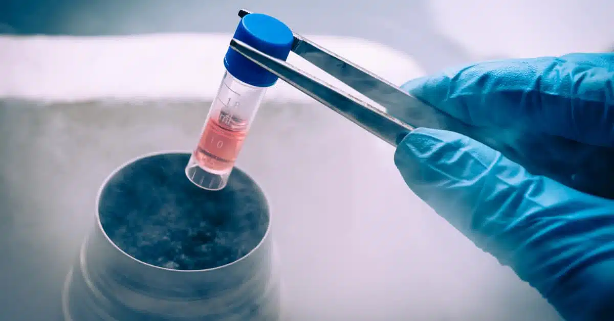 ما هي شروط التبرع بالخلايا الجذعية؟