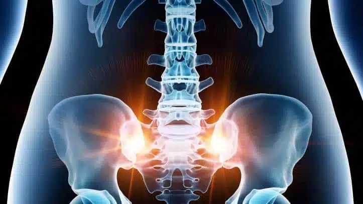 ما هي أعراض خشونة مفصل الحوض؟