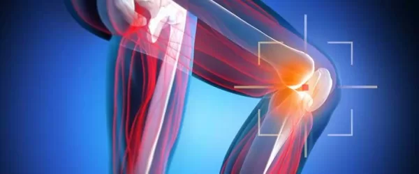 سعر الاشعه الرنين على الركبه وماذا يكشف هذا الإجراء للاطباء؟