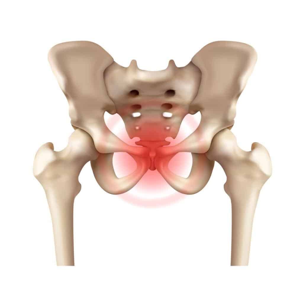 Get to Know the Coccyx and the Causes of Pain in It!