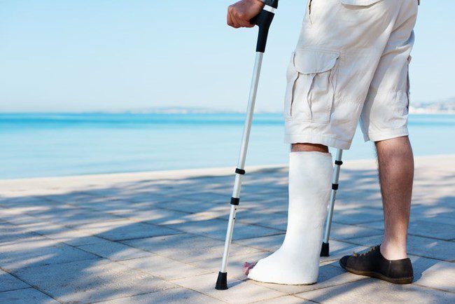 Can You Walk on a Broken Leg?
