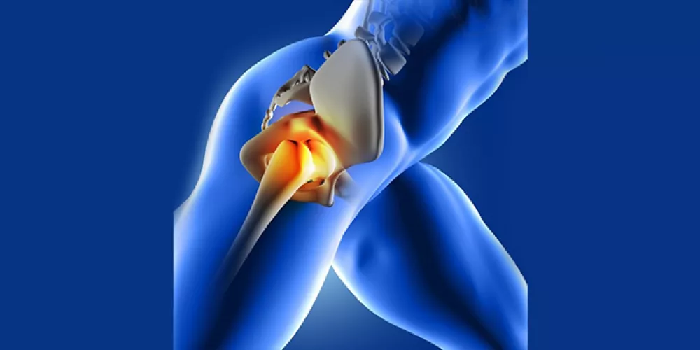 Symptoms of hip joint degeneration