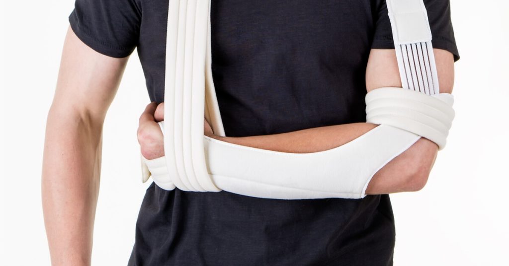 أنواع كسر الكتف وطرق العلاج