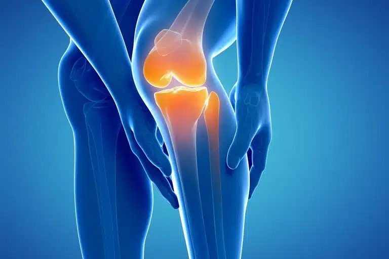 47 132357 knee stiffness causes treatment 4