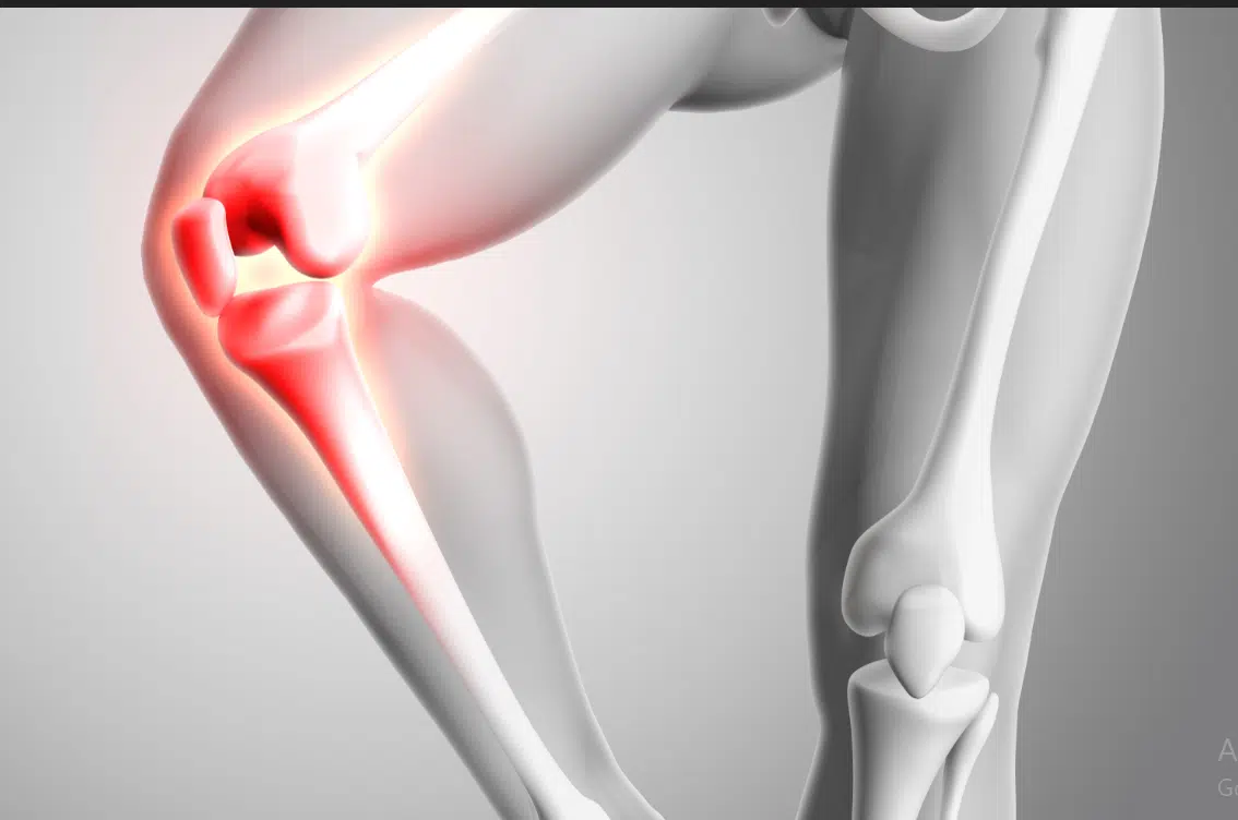 ادوية لعلاج خشونة الركبة