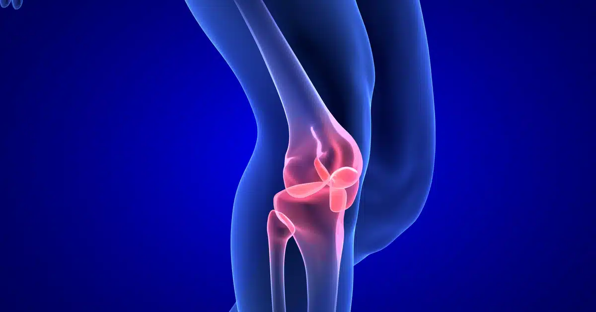 كم مدة علاج قطع الرباط الصليبي؟