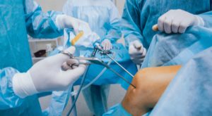 العلاج الجراحي لتورم الركبة